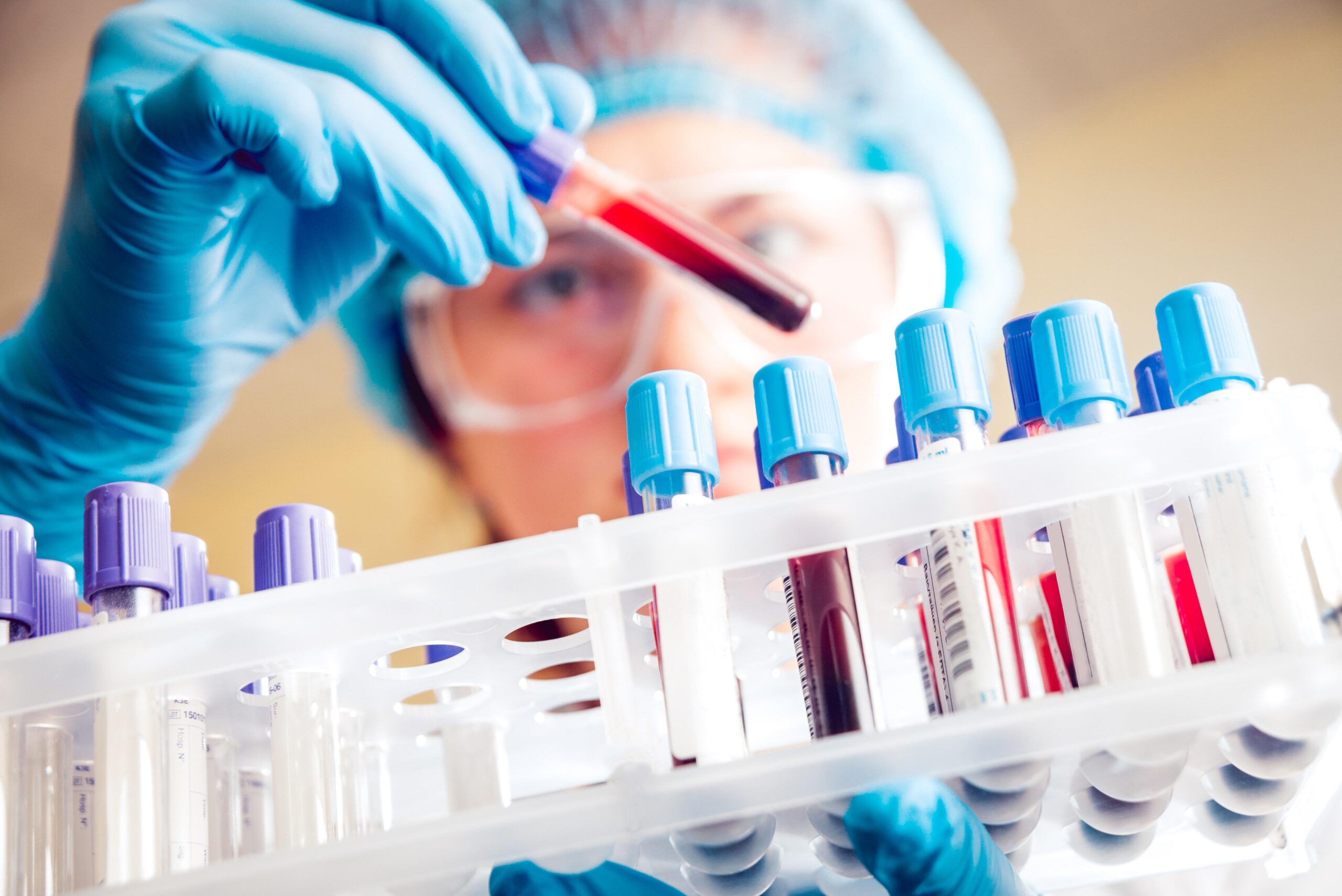 Best Blood Test Lab in Minjur